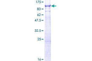 SMPD3 Protein (AA 1-655) (GST tag)