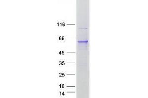 Validation with Western Blot