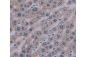 Immunohistochemistry (IHC) image for anti-Myosin, Light Chain 1, Alkali, Skeletal, Fast (MYL1) (AA 3-139) antibody (ABIN1859936)