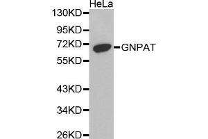 Western Blotting (WB) image for anti-Glyceronephosphate O-Acyltransferase (GNPAT) antibody (ABIN1872854) (GNPAT 抗体)