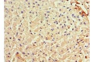 Immunohistochemistry of paraffin-embedded human liver tissue using ABIN7144581 at dilution of 1:100 (Liver Arginase 抗体  (AA 1-322))