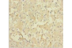 Immunohistochemistry of paraffin-embedded human liver tissue using ABIN7151627 at dilution of 1:100 (NEIL1 抗体  (AA 2-390))