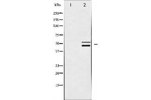Western blot analysis of Shc expression in CalyculinA treated HeLa whole cell lysates,The lane on the left is treated with the antigen-specific peptide. (SHC1 抗体)