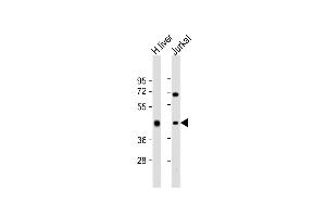All lanes : Anti-ADH1B Antibody (Center) at 1:2000 dilution Lane 1: human liver lysate Lane 2: Jurkat whole cell lysate Lysates/proteins at 20 μg per lane. (ADH1B 抗体  (AA 209-237))