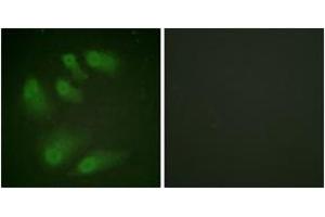 Immunofluorescence analysis of HeLa cells, using Chk1 (Phospho-Ser286) Antibody. (CHEK1 抗体  (pSer286))