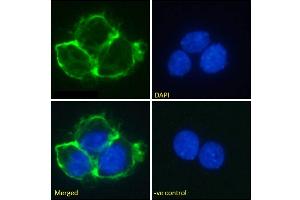 Immunofluorescence staining of fixed A431 cells with anti-EGFR antibody Matuzumab. (Recombinant EGFR (Matuzumab Biosimilar) 抗体  (Extracellular Domain))
