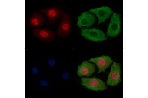 ABIN6256342 and ABIN6267479 staining Hela cells(4h of LPS treatment) by IF/ICC.