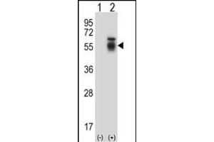 Western blot analysis of ACVR1 (arrow) using rabbit polyclonal ACVR1 Antibody (Center) (ABIN657777 and ABIN2846752). (ACVR1 抗体  (AA 132-161))