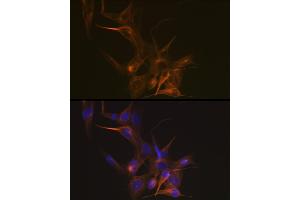 Immunofluorescence analysis of NIH-3T3 cells using Tubulin beta-1 chain Rabbit mAb (ABIN7271045) at dilution of 1:100 (40x lens). (TUBB1 抗体)