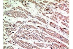 Immunohistochemistry (IHC) analysis of paraffin-embedded Human Heart, antibody was diluted at 1:200. (Macrophage Mannose Receptor 1 抗体  (Internal Region))