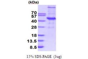 SDS-PAGE (SDS) image for Ubiquitin-Conjugating Enzyme E2Q Family Member 2 (UBE2Q2) (AA 1-375) protein (His tag) (ABIN5854280)