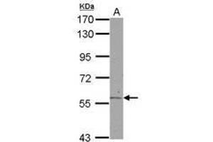 Image no. 2 for anti-Aldehyde Dehydrogenase 6 Family, Member A1 (ALDH6A1) (AA 1-255) antibody (ABIN1496604) (ALDH6A1 抗体  (AA 1-255))
