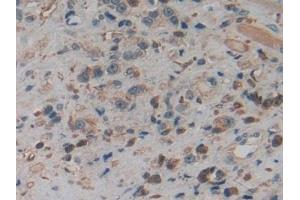 Immunohistochemistry (IHC) image for anti-Pyruvate Kinase M2 (PKM2) (AA 141-248) antibody (ABIN7432133)