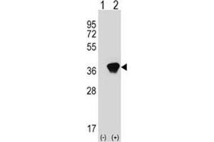 Western blot analysis of AKR1A1 antibody and 293 cell lysate (2 ug/lane) either nontransfected (Lane 1) or transiently transfected (2) with the AKR1A1 gene. (AKR1A1 抗体  (AA 293-325))
