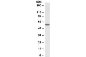 Western blot testing of human skeletal muscle lysate with DIXDC1 antibody at 0. (DIXDC1 抗体)
