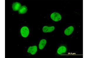 Immunofluorescence (IF) image for anti-Minichromosome Maintenance Complex Component 3 (MCM3) (AA 699-808) antibody (ABIN517773)