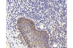 Immunohistochemistry analysis of paraffin-embedded human tonsil using PERK Polyclonal Antibody at dilution of 1:400. (PERK 抗体)