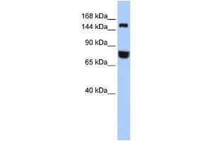 WB Suggested Anti-EEA1  Antibody Titration: 0. (EEA1 抗体  (Middle Region))