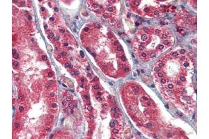 Human Kidney: Formalin-Fixed, Paraffin-Embedded (FFPE) (AIF 抗体  (AA 593-606))