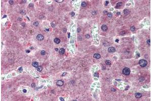 Liver, Human: Formalin-Fixed, Paraffin-Embedded (FFPE) (HYAL1 抗体  (AA 36-85))