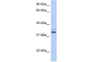 SULT1A1 antibody used at 1 ug/ml to detect target protein.