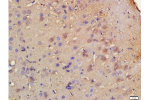 Formalin-fixed and paraffin embedded rat brain labeled with Rabbit Anti-HRH3/GPCR97 Polyclonal Antibody, Unconjugated 1:200 followed by conjugation to the secondary antibody and DAB staining (HRH3 抗体  (AA 121-220))