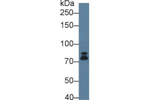 Western Blotting (WB) image for anti-Dicer 1, Ribonuclease Type III (DICER1) (AA 6-290) antibody (ABIN7436789)