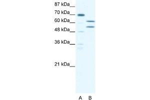 WB Suggested Anti-ZNF297B Antibody Titration: 5. (ZBTB43 抗体  (N-Term))