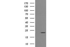 Image no. 2 for anti-CD3 epsilon (CD3E) antibody (ABIN1497222) (CD3 epsilon 抗体)