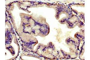 IHC image of ABIN7144136 diluted at 1:400 and staining in paraffin-embedded human prostate tissue performed on a Leica BondTM system. (AGT 抗体  (AA 44-427))