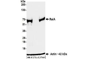 Western Blotting (WB) image for anti-Nuclear Factor-kB p65 (NFkBP65) (C-Term) antibody (ABIN7795799) (Recombinant NF-kB p65 抗体  (C-Term))