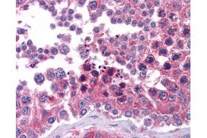 Immunohistochemistry (IHC) image for anti-Signal Transducer and Activator of Transcription 6, Interleukin-4 Induced (STAT6) (C-Term) antibody (ABIN2777200)