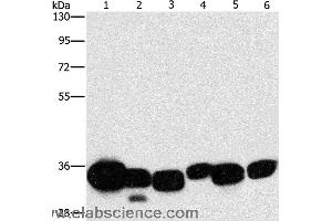 Western blot analysis of Mouse liver and human fetal lung tissue, hela cell and mouse kidney tissue, human brain malignant glioma tissue and K562 cell, using CBR1 Polyclonal Antibody at dilution of 1:1000 (CBR1 抗体)