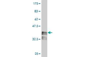 Western Blot detection against Immunogen (37 KDa) . (LHX4 抗体  (AA 291-390))