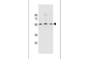 KCNK18 Antibody (Center) (ABIN657542 and ABIN2846557) western blot analysis in SiHa,,MCF-7 cell line lysates (35 μg/lane). (KCNK18 抗体  (AA 168-197))