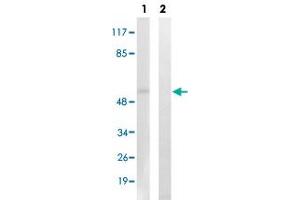 Western blot analysis of Lane 1: Untreated K562 cell lysates, Lane 2: Synthesized peptide treated K562 cell lysates reacted with AKT1/AKT3 (phospho Y437/Y434) polyclonal antibody  at 1:500-1:3000 dilution. (AKT1/3 (pTyr437), (Tyr434) 抗体)