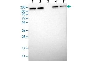 Western blot analysis of Lane 1: RT-4, Lane 2: U-251 MG, Lane 3: Human Plasma, Lane 4: Liver, Lane 5: Tonsil with UGCGL1 polyclonal antibody . (UGGT1 抗体)