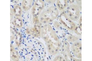 Immunohistochemistry of paraffin-embedded Rat kidney using UBE3A Polyclonal Antibody at dilution of 1:200 (40x lens). (ube3a 抗体)