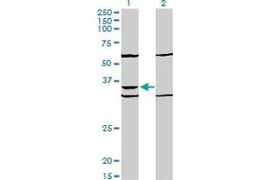 Western Blot analysis of PAX9 expression in transfected 293T cell line by PAX9 monoclonal antibody (M03), clone 4B9. (PAX9 抗体  (AA 205-300))