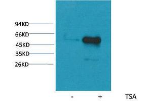 Western Blot (WB) analysis of extracts from HeLa cells, untreated (-) or treated with TSA (1muM, 18 hr+), using Acetyl- a-tubulin(Lys40) Mouse Monoclonal Antibody 1:2000.