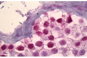 Anti-MSK1 antibody IHC staining of human testis. (MSK1 抗体)