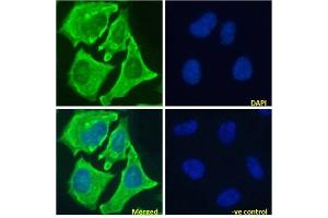 Immunofluoresence staining of fixed HeLa cells with anti-Notch 1 antibody E6. (Recombinant Notch1 抗体)