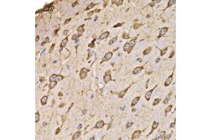 Immunohistochemistry of paraffin-embedded mouse brain using RPS14 antibody at dilution of 1:100 (x400 lens). (RPS14 抗体)