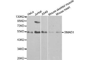 Western blot analysis of extracts of various cell lines,using SMAD1 antibody.