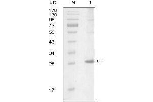 Western blot analysis using ITK mouse mAb against truncated Trx-ITK recombinant protein (1). (ITK 抗体  (AA 2-110))