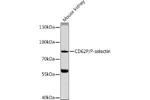 Western blot analysis of extracts of mouse kidney, using CD62P/P-selectin Antibody (ABIN6131512, ABIN6147501, ABIN6147504 and ABIN6216152) at 1:1000 dilution. (P-Selectin 抗体  (AA 220-319))