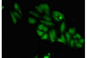 Immunofluorescent analysis of Hela cells using ABIN7150733 at dilution of 1:100 and Alexa Fluor 488-congugated AffiniPure Goat Anti-Rabbit IgG(H+L) (Mps1 抗体  (AA 370-492))