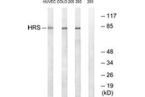 Western blot analysis of extracts from 293/COLO/HuvEc cells, using HRS (Ab-334) Antibody. (HRS (HRS) (AA 301-350) 抗体)