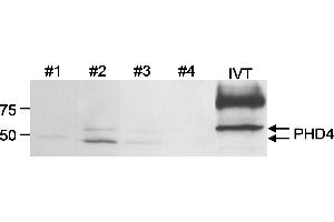 Western Blotting (WB) image for anti-Prolyl 4-Hydroxylase, Transmembrane (Endoplasmic Reticulum) (P4HTM) (C-Term) antibody (ABIN7449275) (P4HTM 抗体  (C-Term))