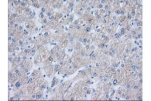 Immunohistochemical staining of paraffin-embedded Human liver tissue using anti-TTC32 mouse monoclonal antibody. (TTC32 抗体)